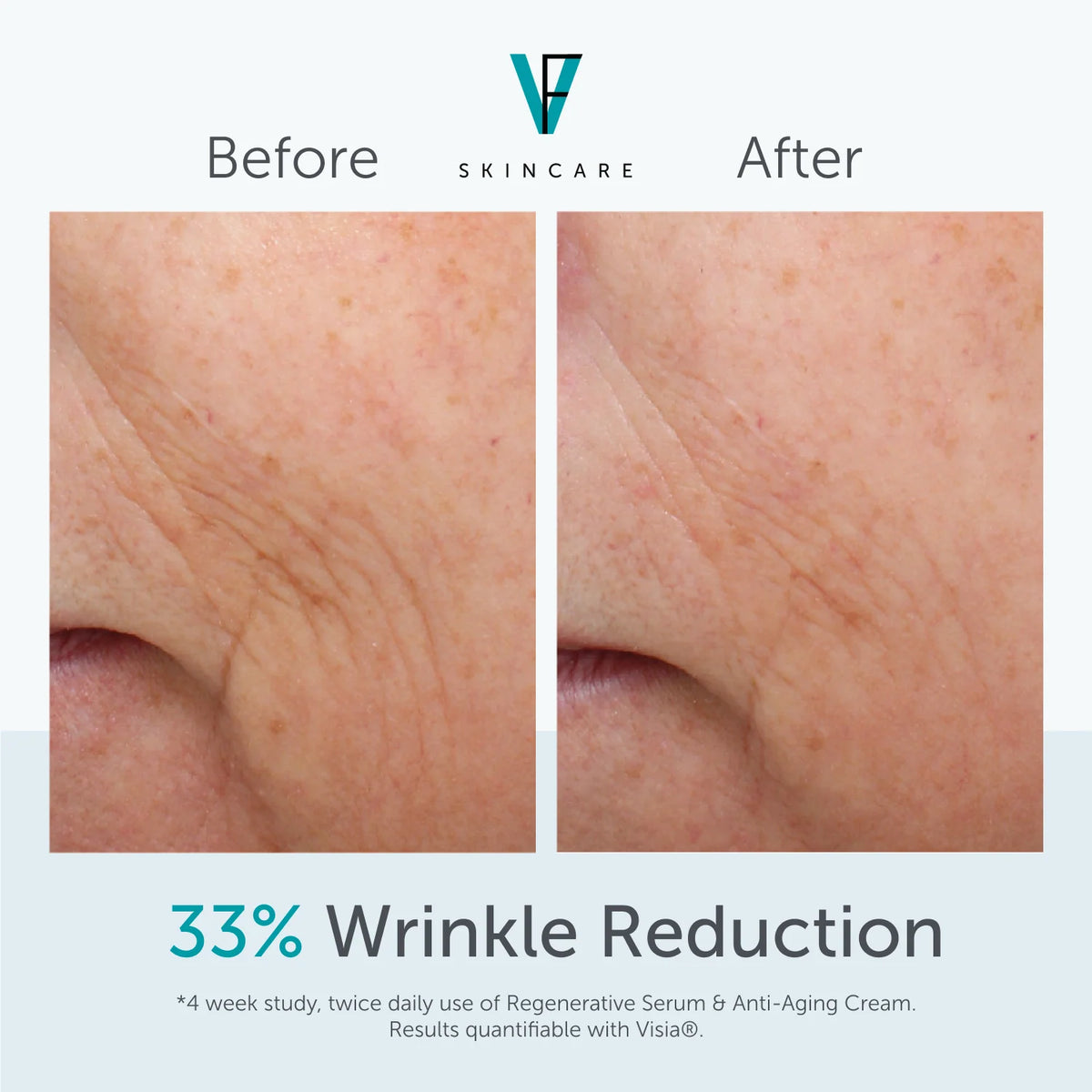 Factor Five Anti-Aging Cream